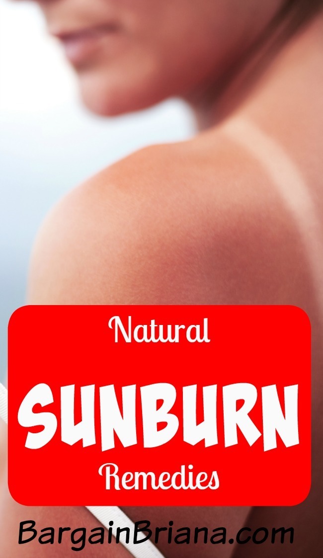 Natural Sunburn Remedies 1566